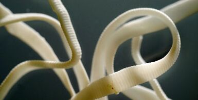 επίπεδο παράσιτο από το ανθρώπινο σώμα